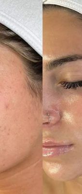 18d204e612b65525cab34b9092286e94