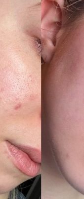 27436cd762efd55070f960cc0a81f1e2