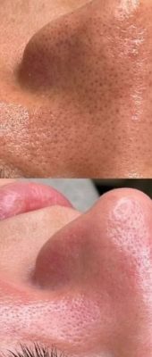 3c71ad16dcfbd652c5aac8e20fb2d36b