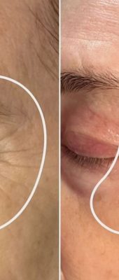 b4b1238cb15cbf6e092a95bd13a92763