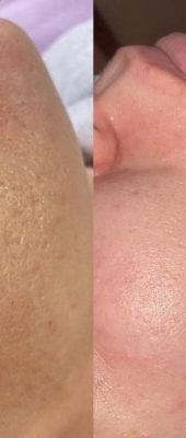 dae1e32a5dcdd101dc44081953acaa8a